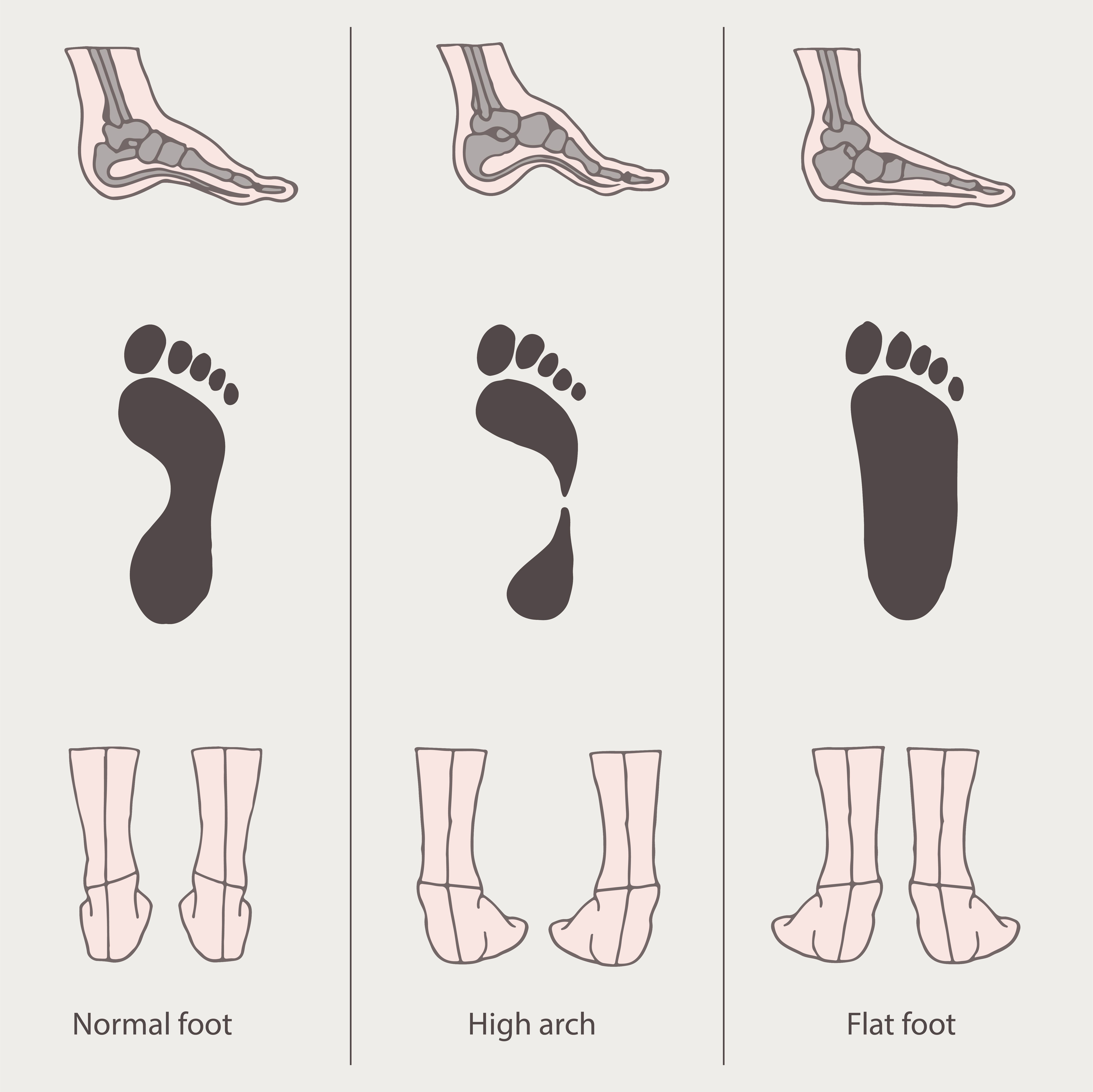 reservoir hardware Young lady Blog - Pantofi dama – Cum ii alegem in functie de forma piciorului?